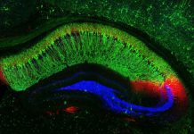 They call it stupid hot for a reason: Heat muddles animal brains