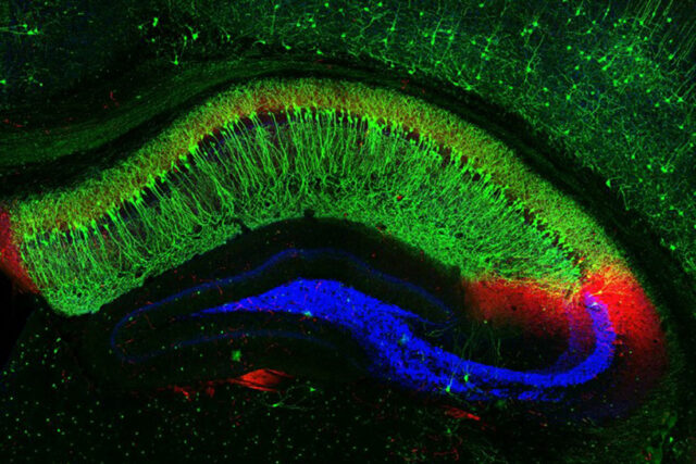 p-mouse-hippocampus-640x427.jpg
